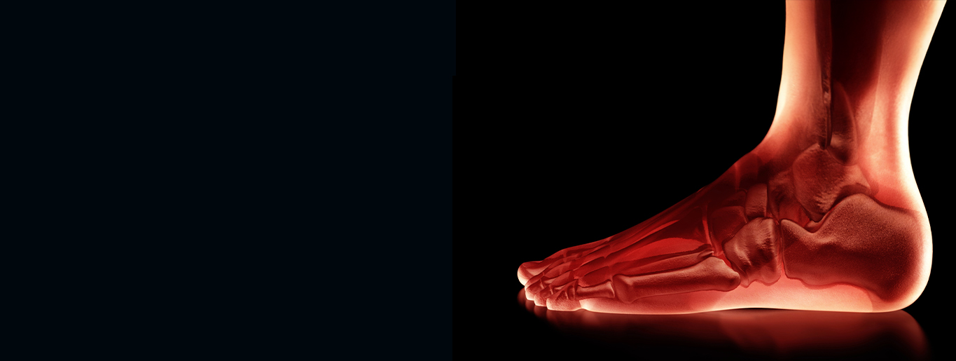 x-ray of foot